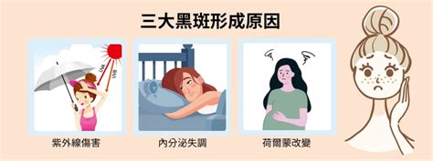 胸部下長斑|曬斑、肝斑、長斑怎麼辦？有效淡化斑點5個方法：淡。